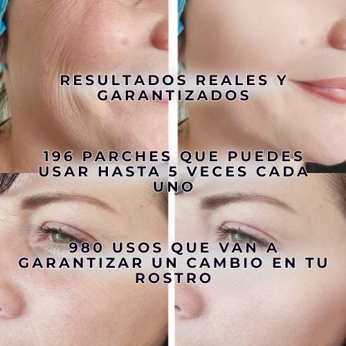 ✨ Luce hasta 10 años más joven sin cirugías ni inyecciones ✨ 192 PARCHES👇