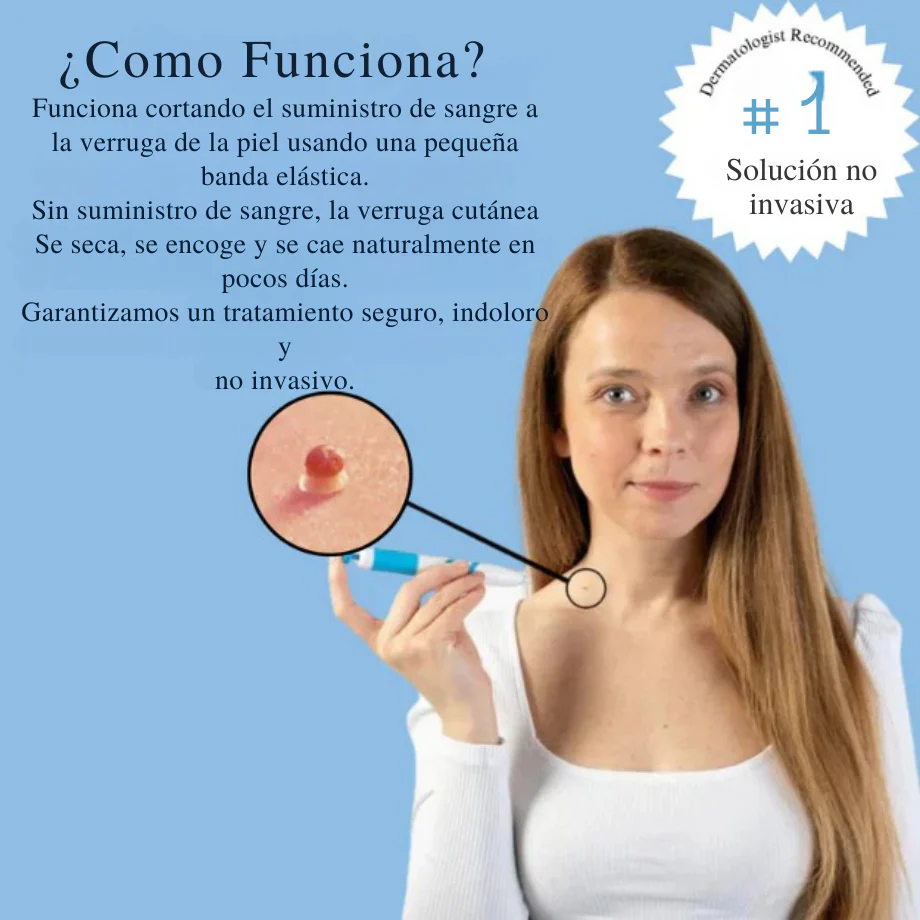 KIT REMOVEDOR ✅ ¡Elimina verrugas y marcas de la piel desde casa, sin químicos ni dolor! OFERTA ESPECIAL👇