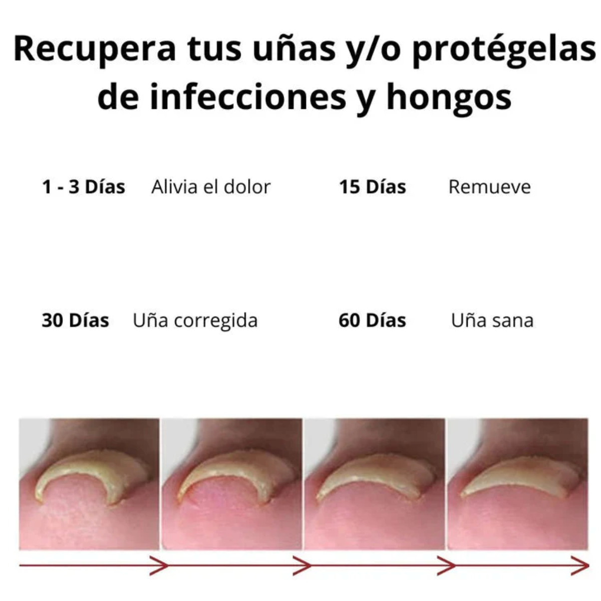 ANTI HONGO TOENAILPLUS 🌿 SÉRUM NATURAL PARA EL CUIDADO DE TUS UÑAS PAGA 1️⃣LLEVA 2️⃣👇
