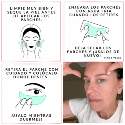 ✨ Luce hasta 10 años más joven sin cirugías ni inyecciones ✨ 192 PARCHES👇