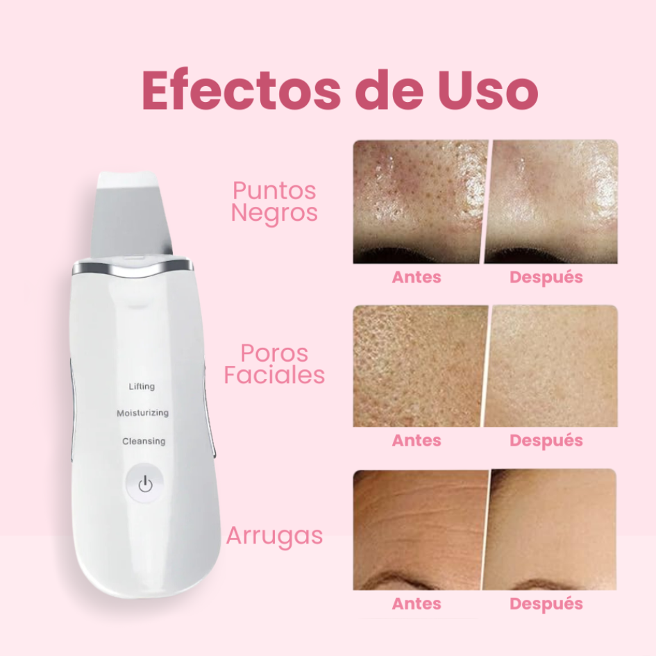 LIMPIADOR FACIAL ULTRASÓNICO 3 EN 1: Spa en Casa para una Piel Radiante ✨ DESCUENTO ESPECIAL NAVIDAD🎄