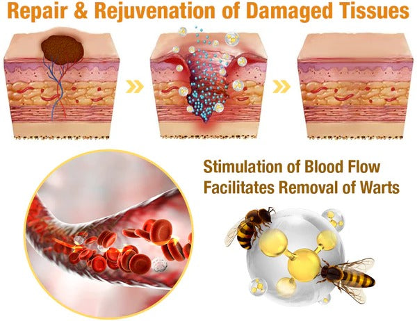 TAG RECEDE ✨ Elimina Manchas y Verrugas SIN Dolor  – Ideal para Piel Sensible ✨ ¡PAGA 1 LLEVA 2!👇