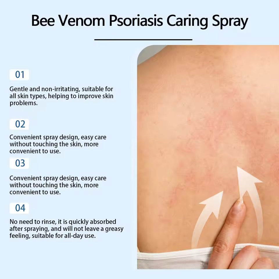 KOLMAX Dile Adiós a la Psoriasis: Alivio Instantáneo con Ingredientes Naturales 🌿✨