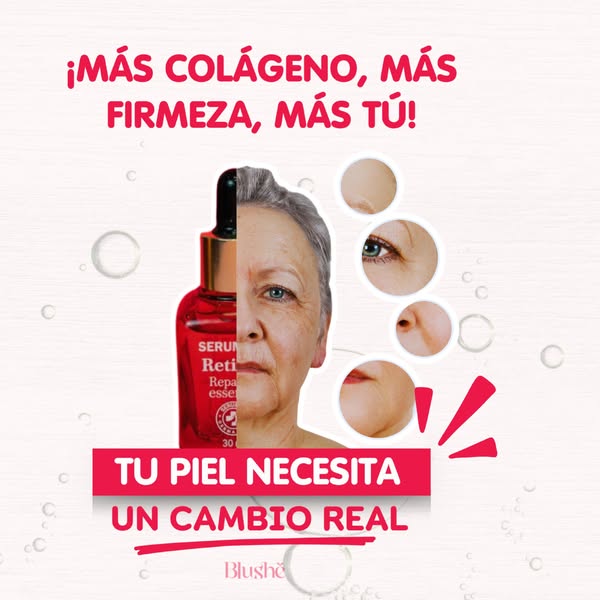 ✨DESCUBRE EL PODER DE RETINOL 10: Piel Firme, Radiante y Rejuvenecida ✨ PAGA 1️⃣ LLEVA 2️⃣ SOLO POR HOY👇