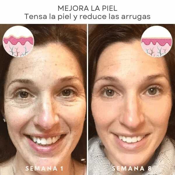 REAFIRMA Y REDUCE TU PAPADA Y ARRUGAS🎁REGALO CREMA PARA DOLORES🎁 ¡Luce Radiante y Siéntete Como Nuevo! 🌟