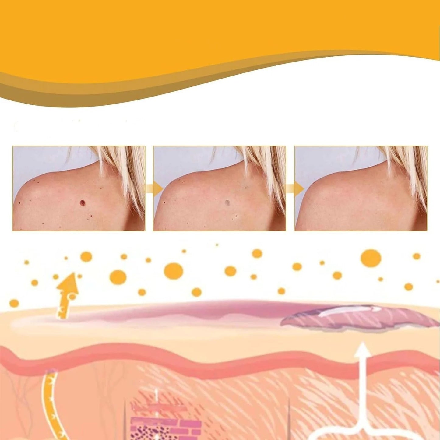 TAG RECEDE ✨ Elimina Manchas y Verrugas SIN Dolor  – Ideal para Piel Sensible ✨ ¡PAGA 1 LLEVA 2!👇